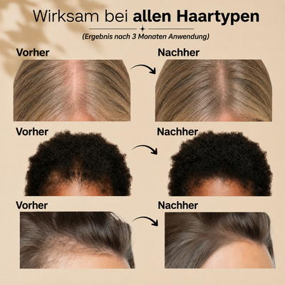 Das Haarserum Nr. 1 in Korea – 100 ml