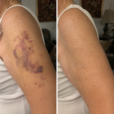 Nerovae — Sérum-Spray Peaux Fragiles