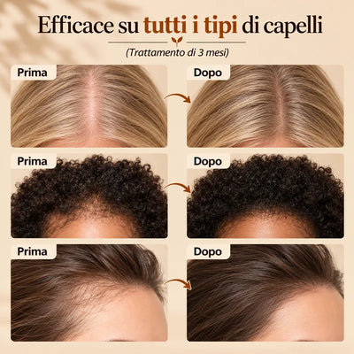 Il siero per capelli N°1 in Corea - 100 ml
